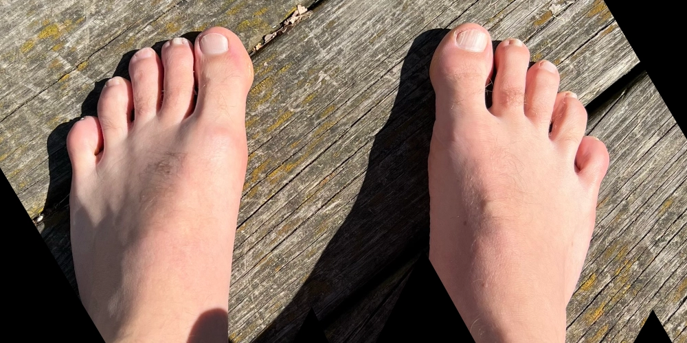 Foot Care for the Trail